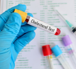 האם באמת צריך לצום לפני בדיקת שומנים בדם? - תמונה